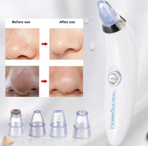 Rechargeable 5-in-1 Blackhead Remover Machine - Derma Suction, Pimple Acne Remover, Pore Vacuum & Deep Face Cleaner - Image 2