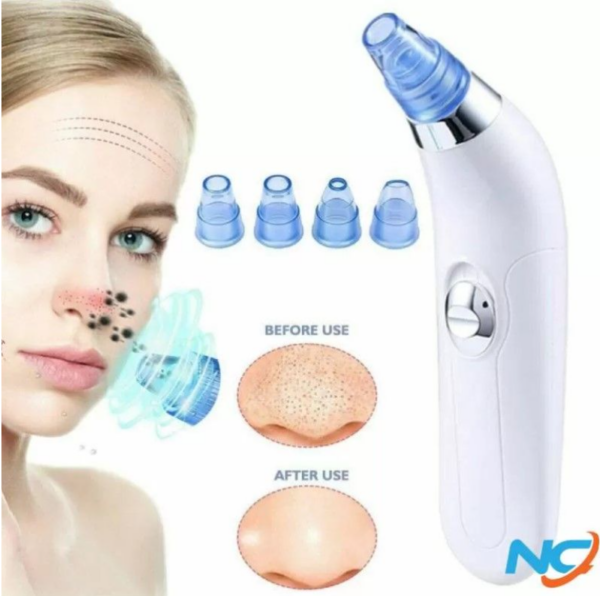 Rechargeable 5-in-1 Blackhead Remover Machine - Derma Suction, Pimple Acne Remover, Pore Vacuum & Deep Face Cleaner - Image 7